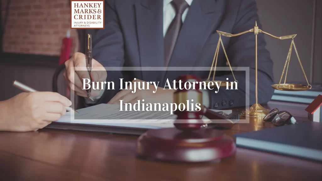 Burn Injury Attorney in Indianapolis